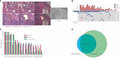 Genomic Landscape in Neoplasm-Like Stroma Reveals Distinct Prognostic Subtypes of Pancreatic Ductal Adenocarcinoma